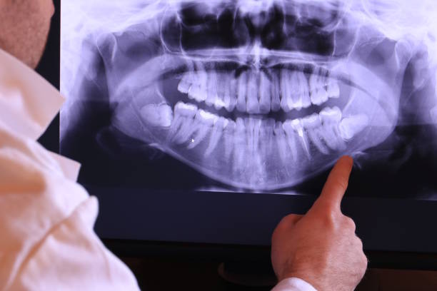 Best Dental Abscess Treatment in Bettendorf, IA